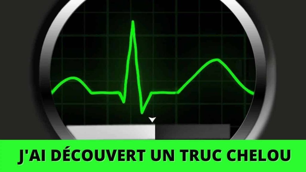 Le truc vraiment CHELOU que je viens de découvrir_jpg